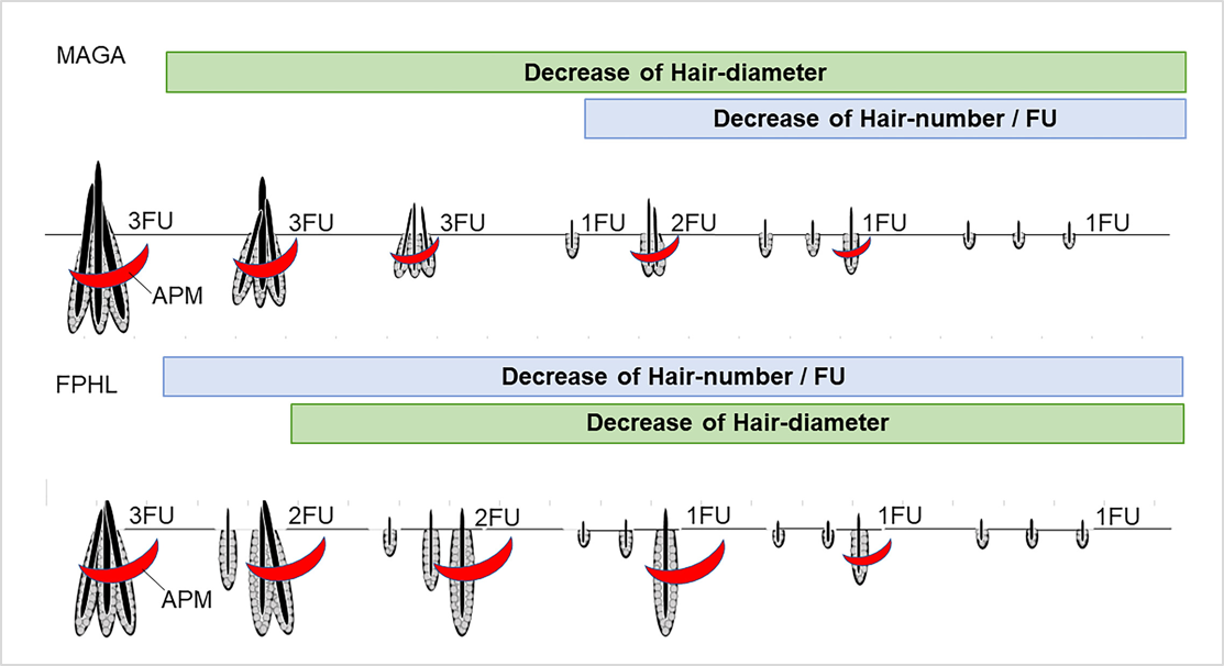 上島朋子医師 Journal of Cosmetic Dermatology （JCD） 論文掲載より.jpg